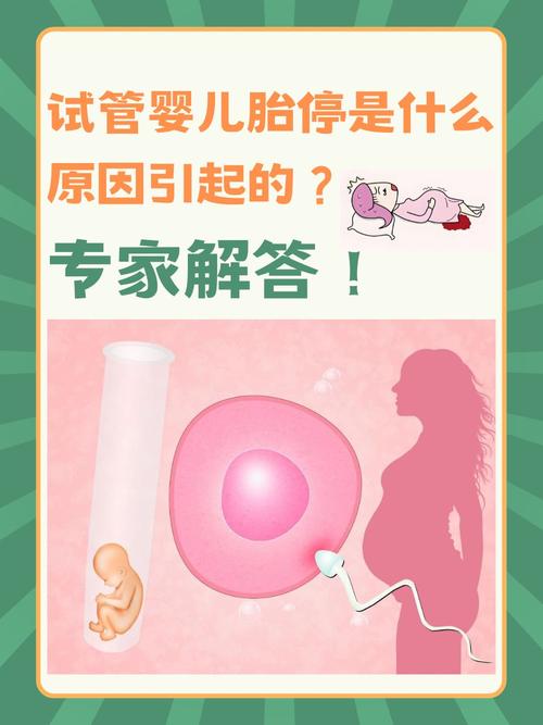 在国内做试管婴儿费用是多少?准备试管婴儿的宝妈们收藏好 在国内做试管婴儿费用是多少?准备试管婴儿的宝妈们收藏好