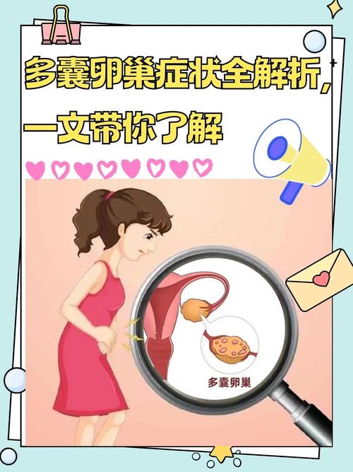 多囊卵巢综合征怎么检查 多囊卵巢综合征怎么检查