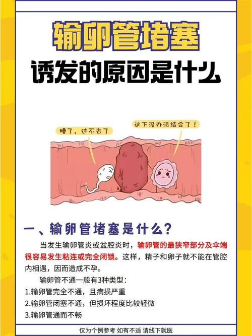 输卵管堵塞的治疗方法 输卵管不通吃什么药好 输卵管堵塞的治疗方法 输卵管不通吃什么药好