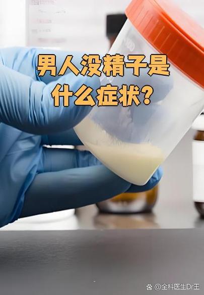 高同型半胱氨酸血症诊疗专家共识(中) 高同型半胱氨酸血症诊疗专家共识(中)